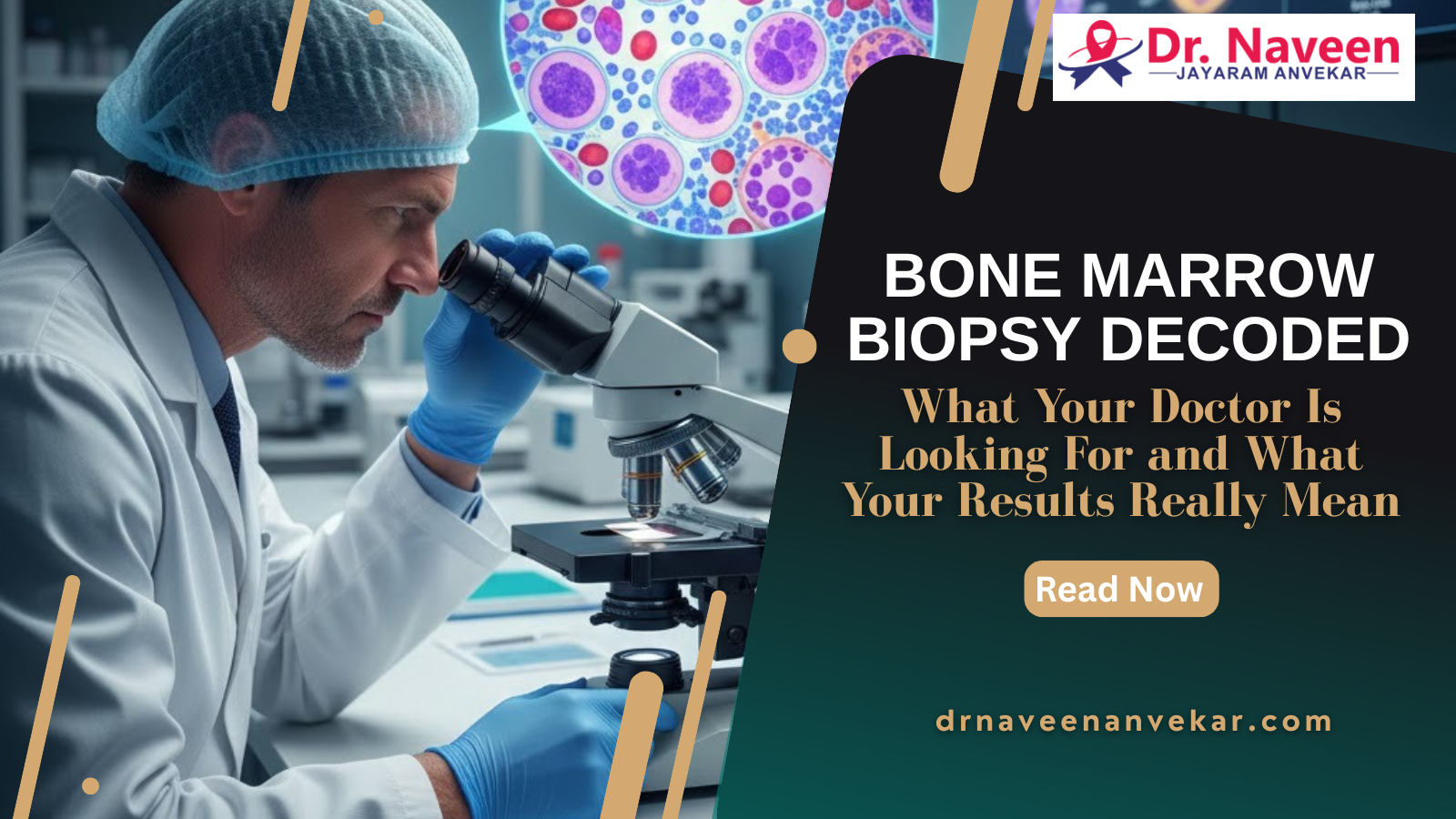 Bone Marrow Biopsy Decoded: What Your Doctor Is Looking For and What Your Results Really Mean